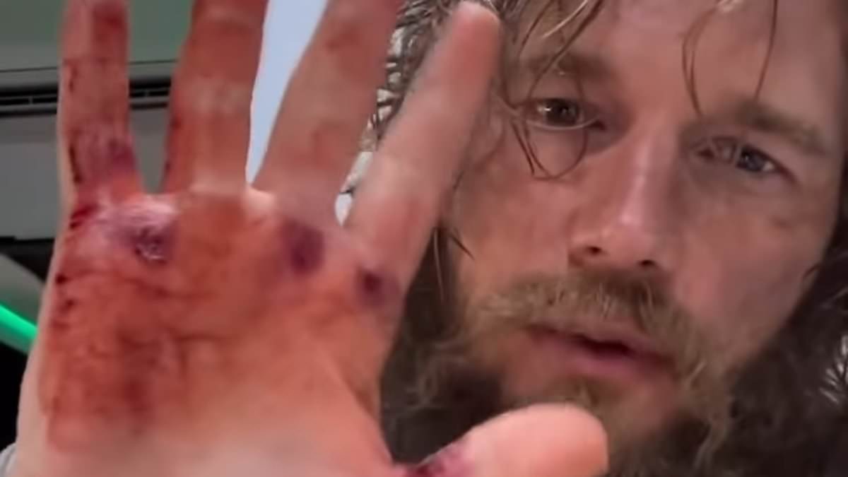 taylor-alert-–-a-list-actor-is-unrecognizable-with-greasy-hair-and-scraggly-beard-in-shocking-photos